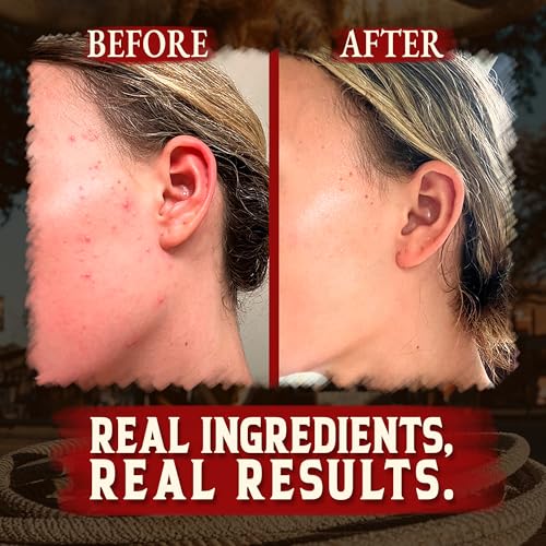 Wrath & Remedy Organic Beef Tallow for Skin - 4 OZ (Vanilla) & Wagyu Beef Tallow for Cooking (14 oz)