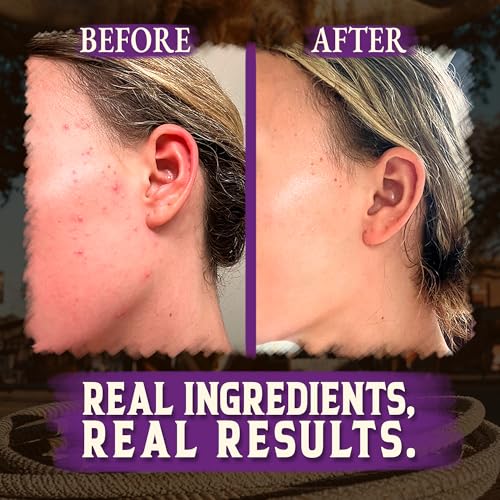 Beef Tallow for Cooking (14 oz) & Organic Beef Tallow for Skin - 4 OZ (Lavender)
