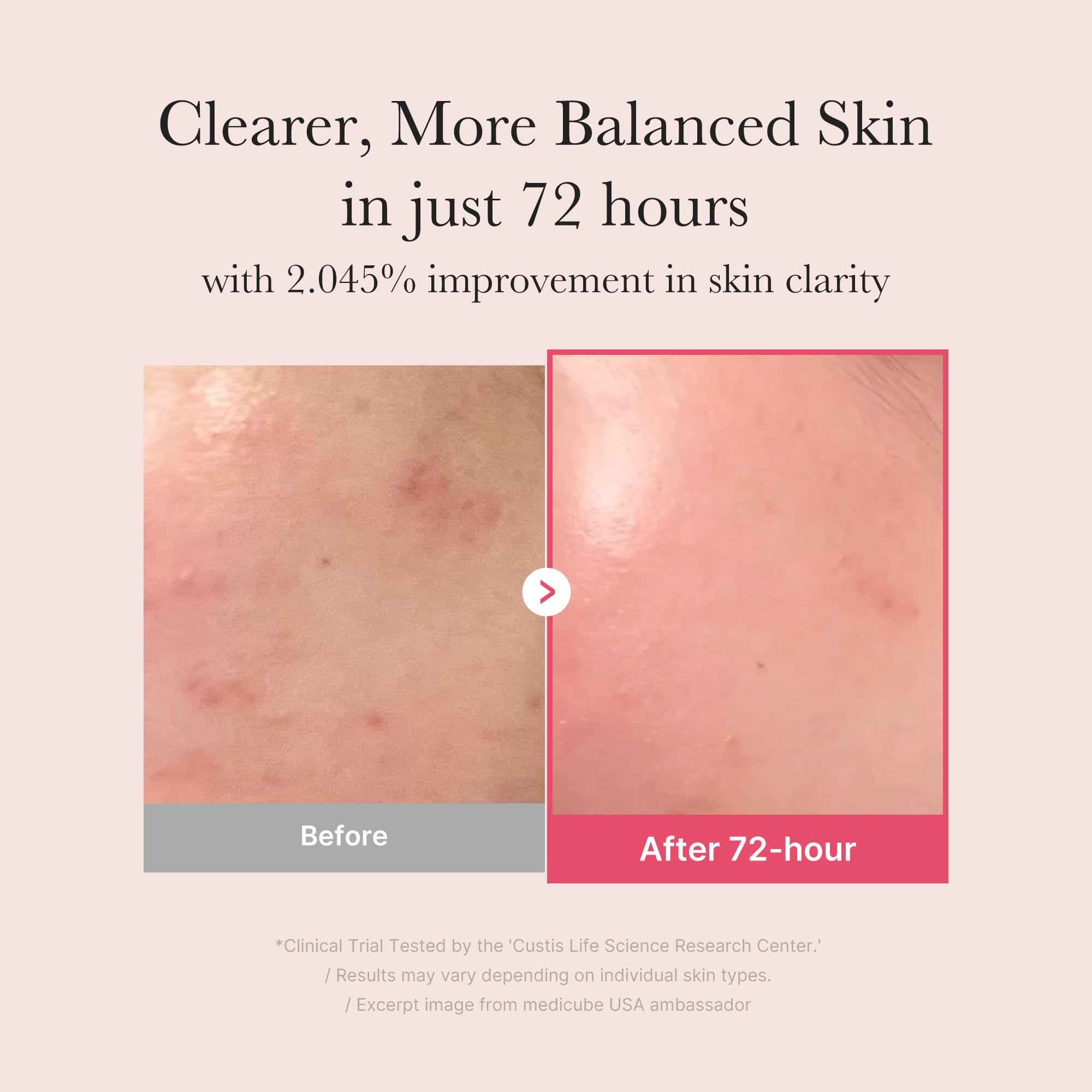 medicube TXA+Niacinamide 15% Glow Facial Serum for After Spot Care | All-in-One Daily Korean Skincare | Uneven Skin Tone, Texture, and Hydration Care | High-Potency Tranexamic Acid 5% | 1.01 fl.oz medicubeBuy Supplements Australia