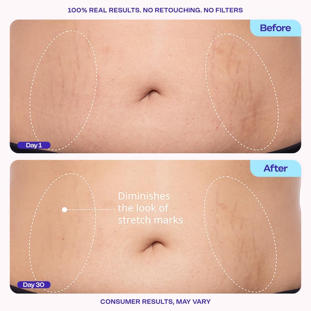 goPure Firming Belly Cream - Body Firming Moisturizer for Visible Cellulite & Stretch Mark Reduction, 4.25oz