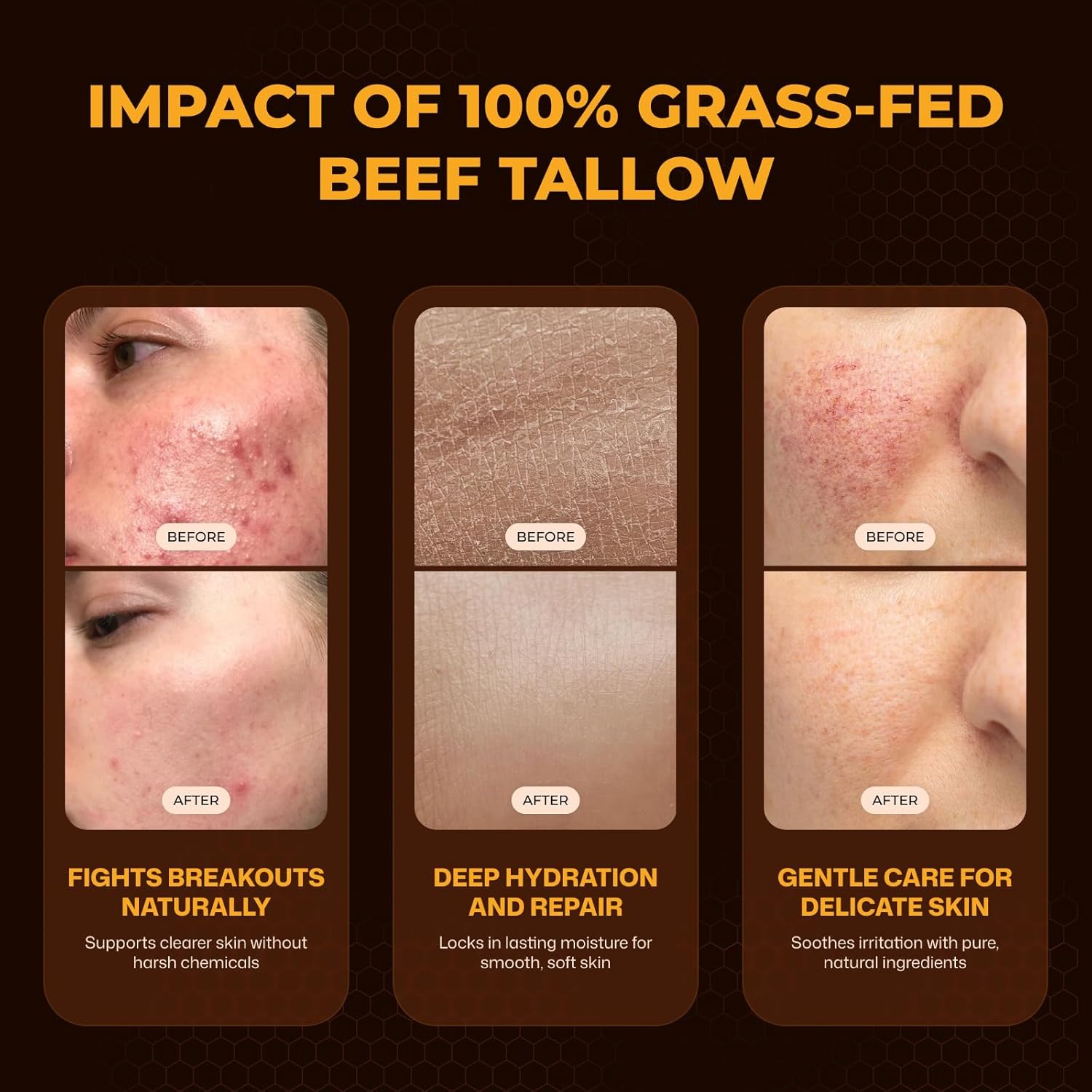 VIORY Tallow and Honey Balm for Face, Beef Tallow for Skin, Moisturizer | With 100% Organic Grass-Fed Beef Tallow & Raw Wild Honey, Natural Formula For Dry & Sensitive Skin (Unscented)