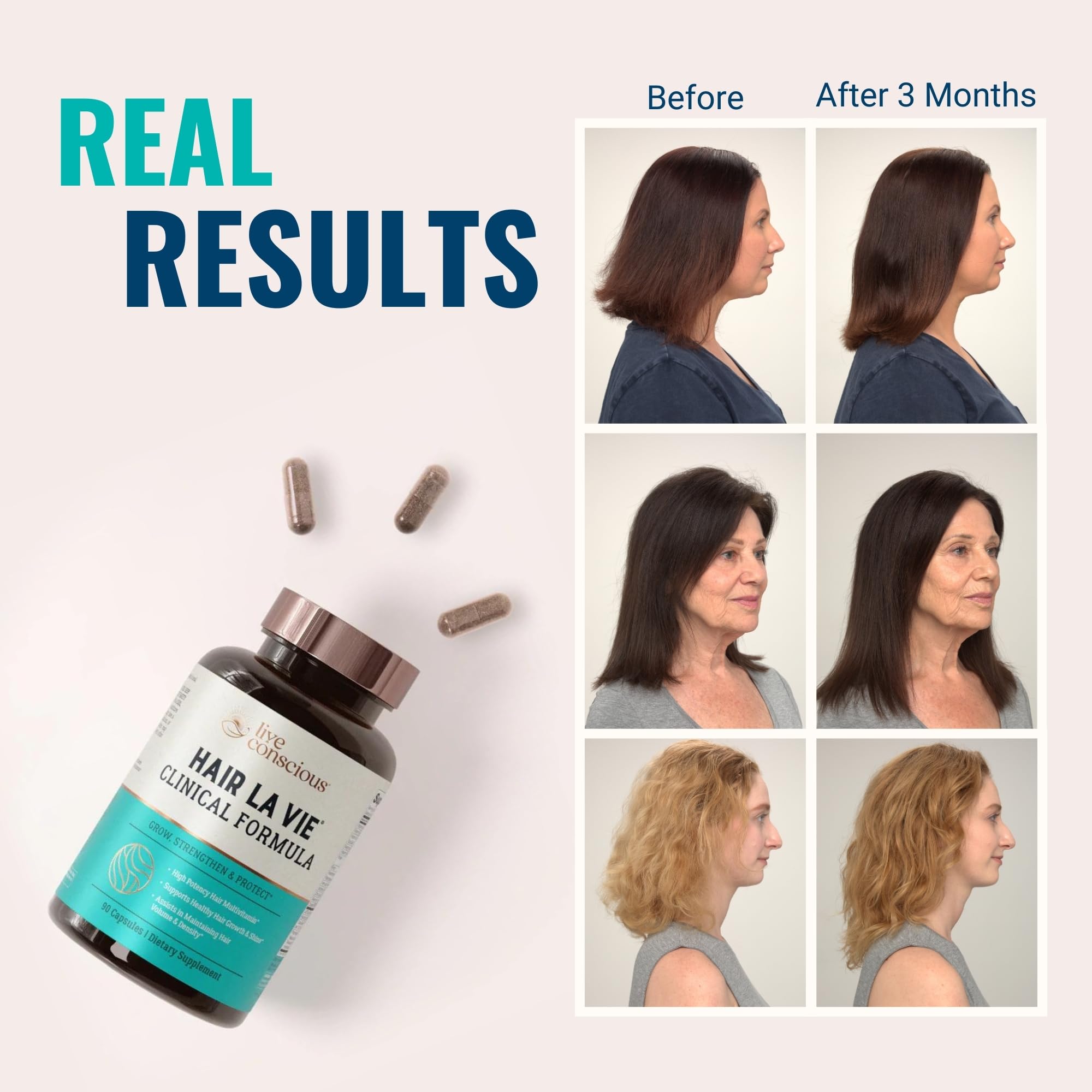 Hair La Vie Live Conscious Clinical Formula Hair Growth Vitamins for Women and Men w/Biotin, Collagen & Saw Palmetto (Pack of 1)