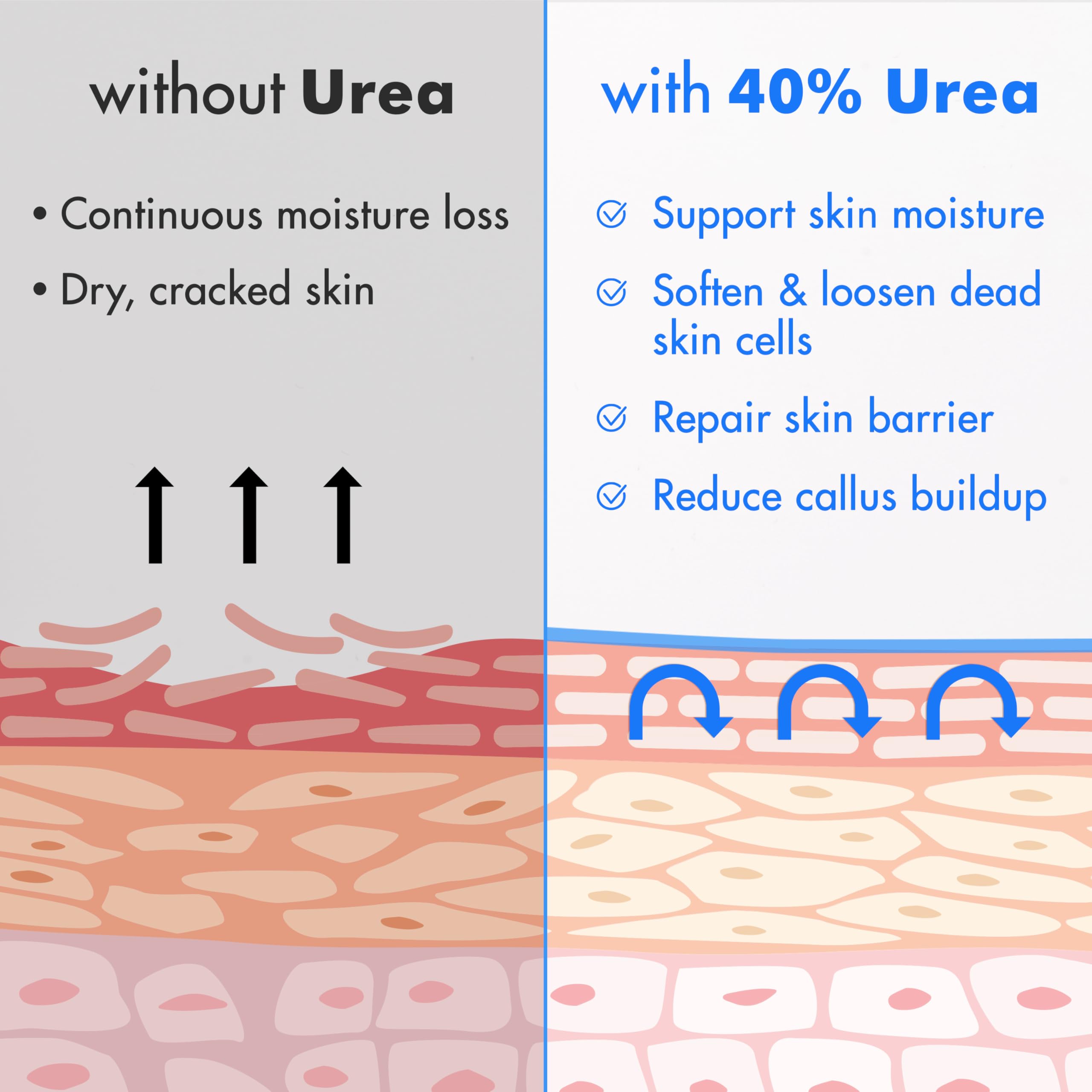 Ebanel Urea Cream 40% plus Salicylic Acid 2%, Foot Cream for Dry Cracked Heels Feet Knees Elbows Hands, Foot Dead Skin Cuticle Callus Remover Toenail Softener, Keratolytic Skin Barrier Repair, 2-Pack