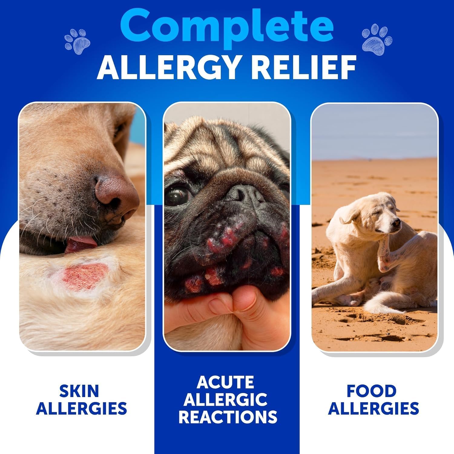 Dog Allergy Relief Chews + Probiotics Bundle - Omega 3 for Skin & Coat, Anti-Itch, Hot Spots Treatment, Immune Support - Probiotics & Prebiotics for Gut Health, Yeast Balance