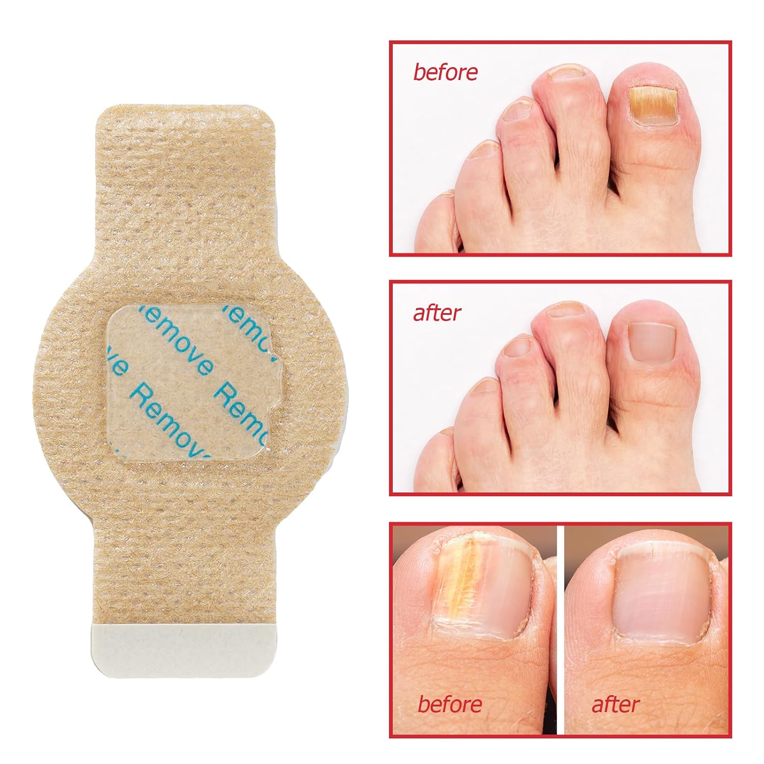 42pcs Toenail Care Patches for Dry, Weak & Cracked Nails, Deeply Moisturizing Nail Surface