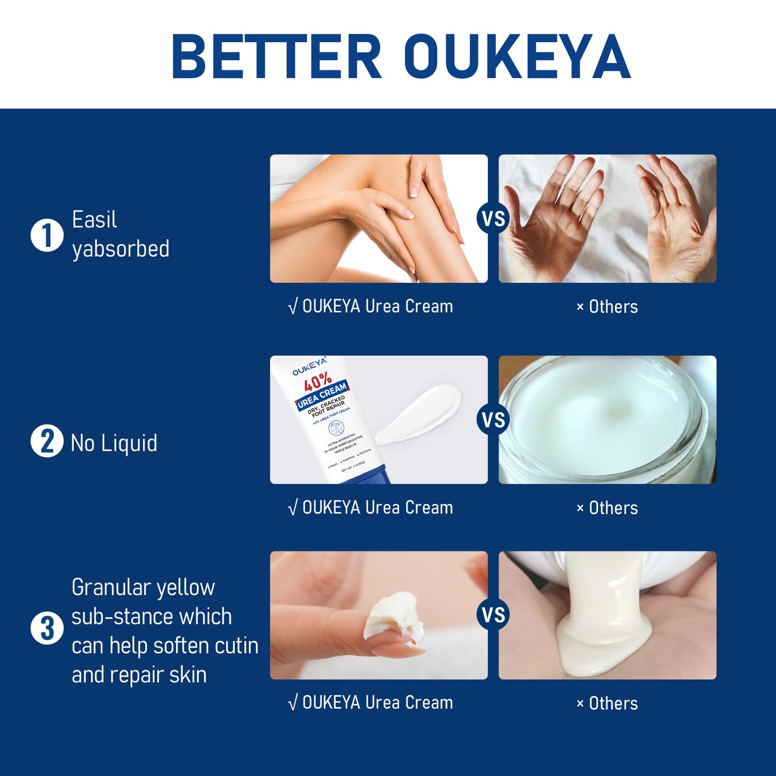 OUKEYA Urea Cream 40 Percent Tube 3 Oz, Foot & Hand Cream for Dry Cracked, 40 per Urea Lotion for Feet Maximum Strength