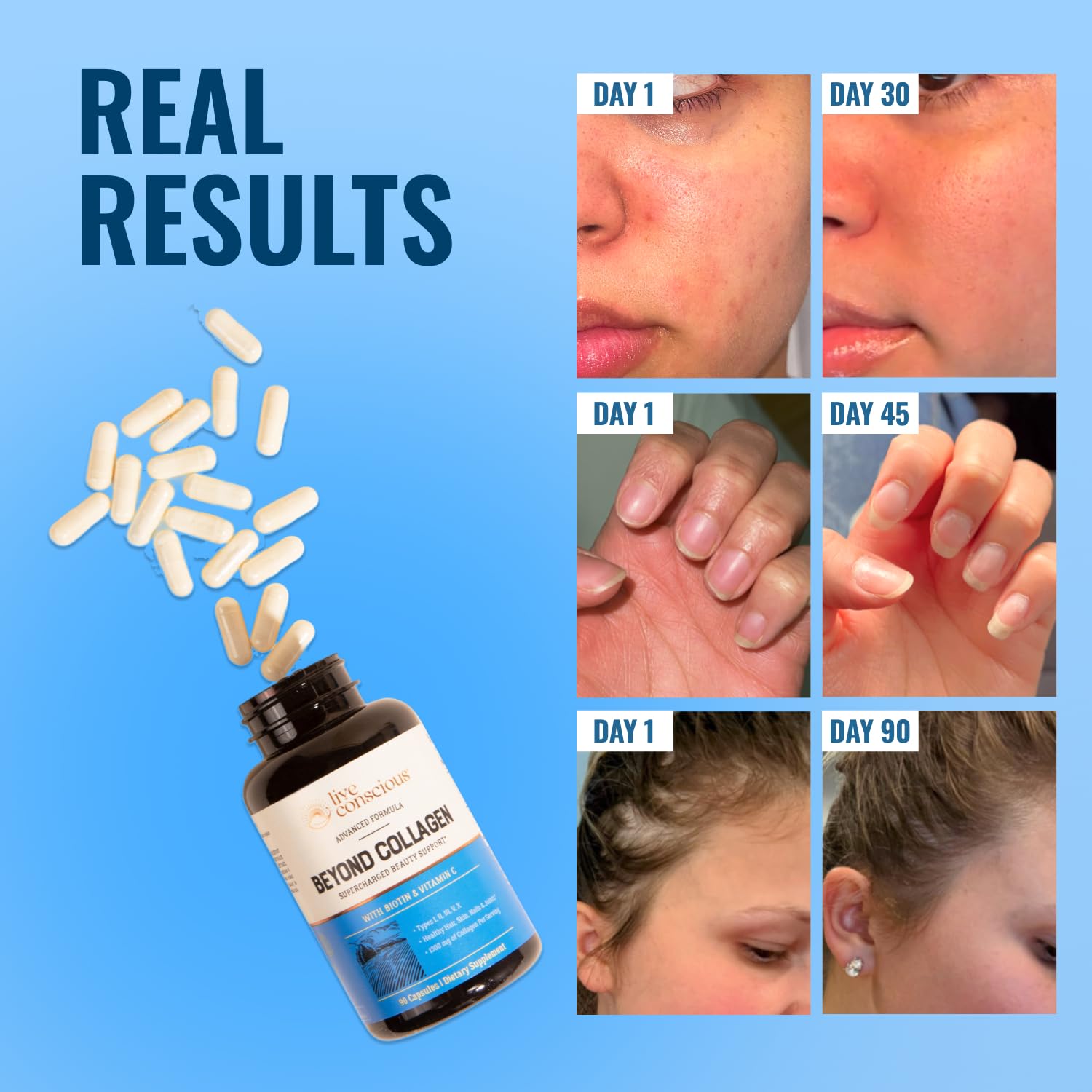 Live Conscious Beyond Collagen Multi Collagen Capsules - Types I, II, III, V & X - Hydrolyzed Blend with Biotin & Vitamin C