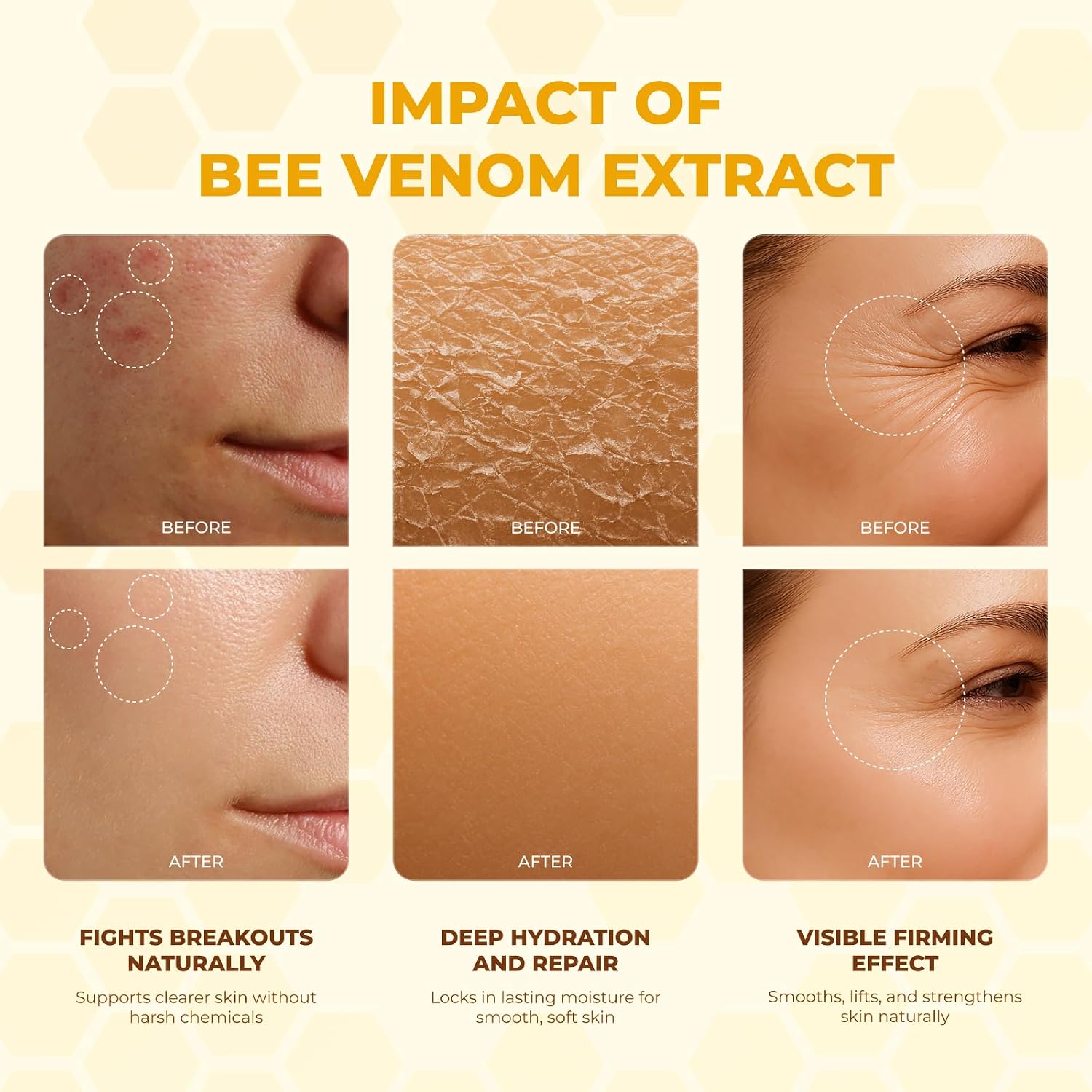 MONIER Bee Venom Cream | Hydrating, Smoothing, Firming, Wrinkle-Reducing | Comprehensive Bee Venom Skin Treatment Cream (Enhanced Formula)