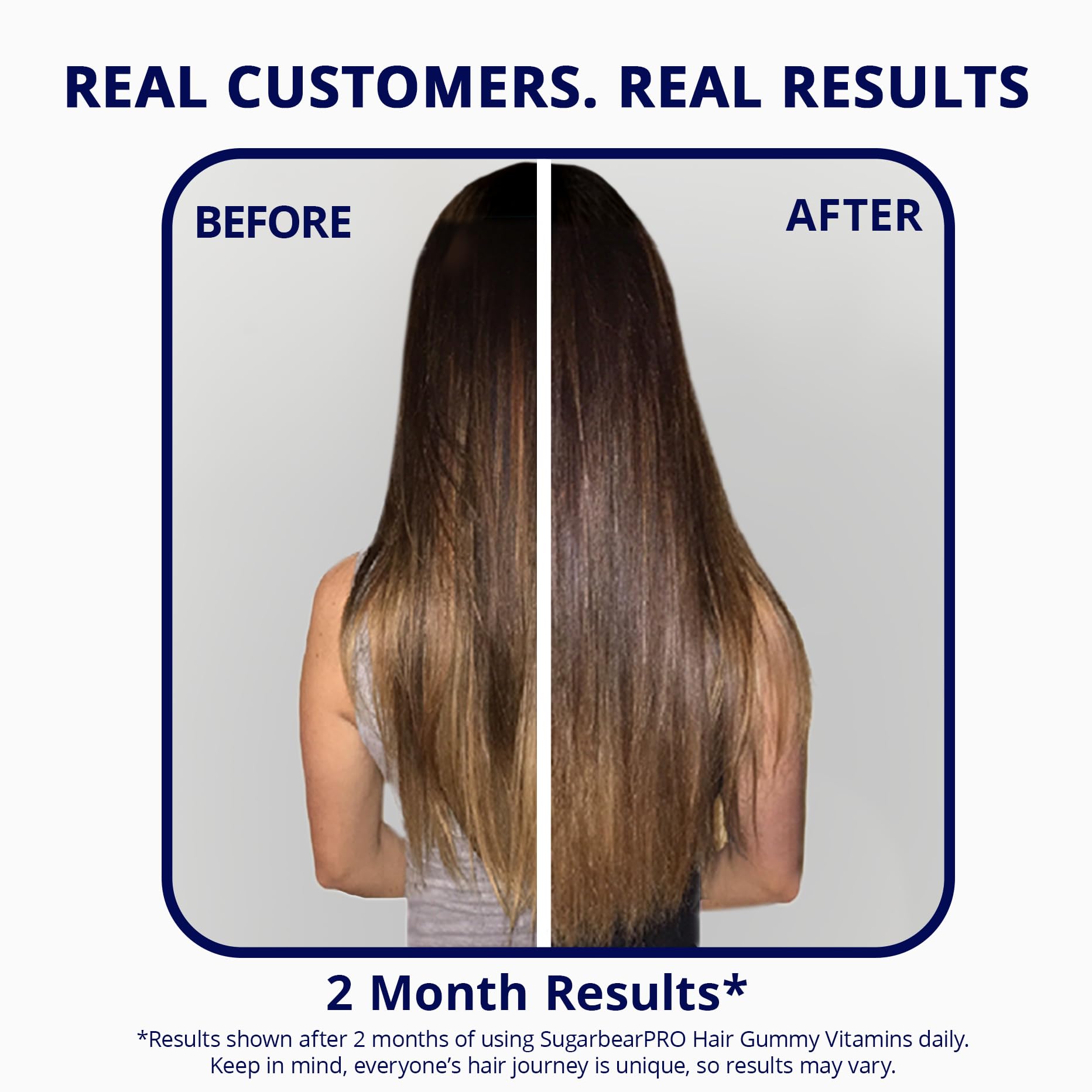 Sugarbear Hair Vitamin Gummy 2 Month Supply Extra Strength Biotin 6000mcg, Growth for Men & Women, Vegan Vitamin B12, MSM, Inositol, Omega 3, Elderberry, Certified Kosher, Halal, Cruelty-Free