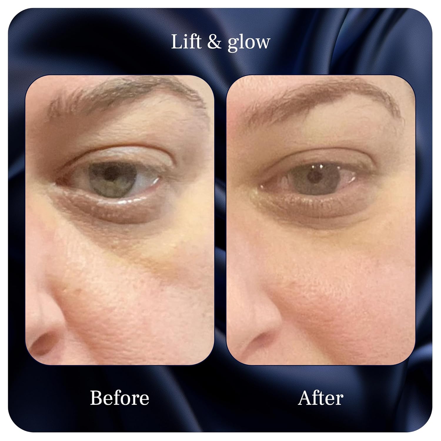 PUREANCE Lift & Glow Organic Eye Cream for Dark Circles & Puffiness | Anti Aging Eye Cream for Wrinkles - Reduces Dark Circles & Under Eye Bags - Kakadu Plum, Coconut Oil, Spirulina - 1 Fl Oz