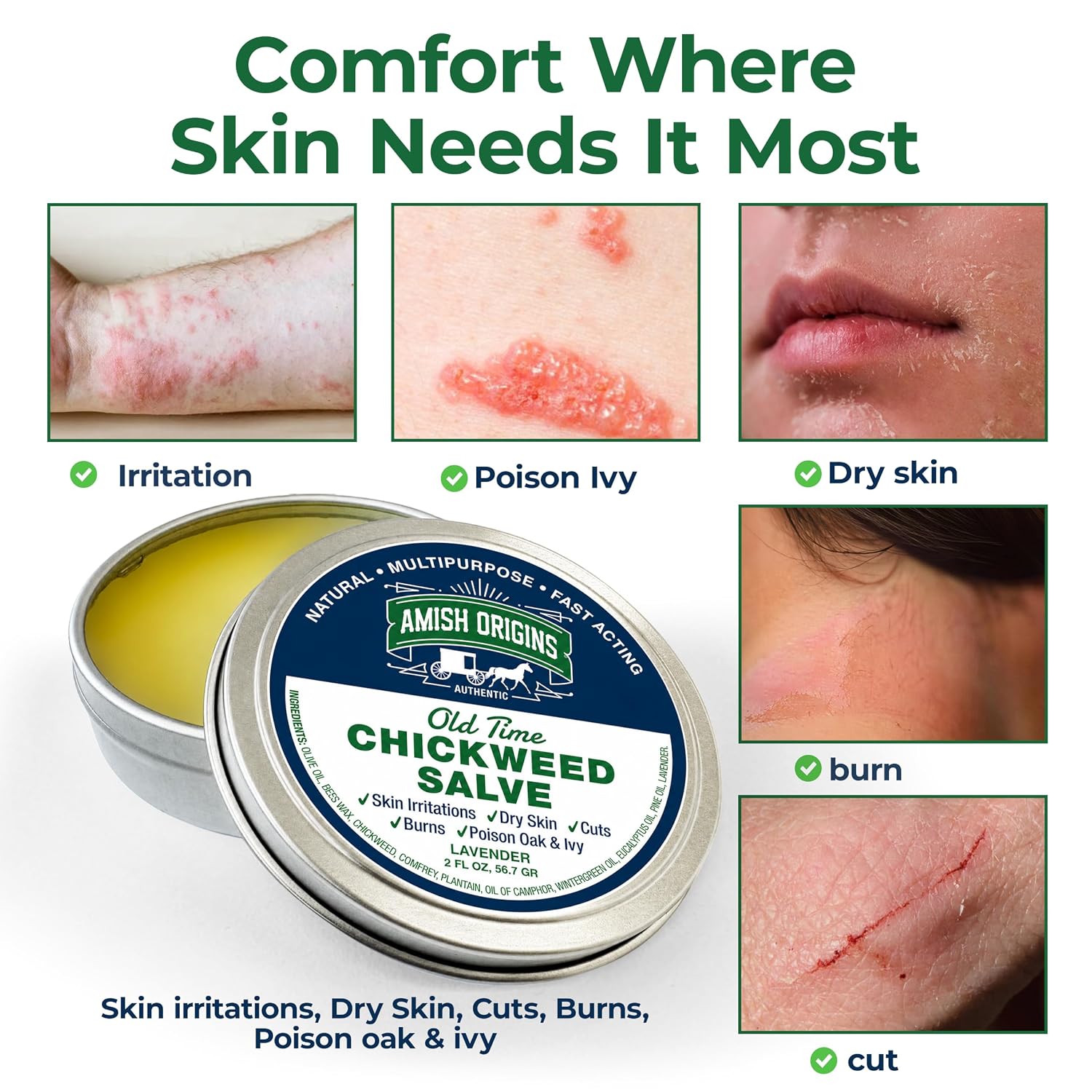 Amish Origins Old Time Chickweed Salve 2 oz- The Ultimate Poison Ivy/Poison Oak Blocker, Healing Salve for Skin Disorder, Irritations, Burns, Minor Cuts