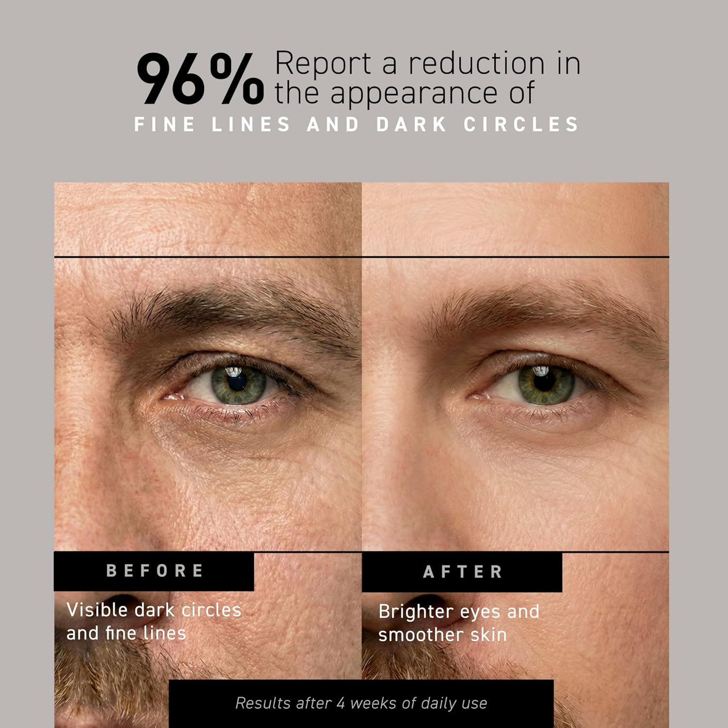 Brickell Men's Restoring Under Eye Cream for Men, Anti Aging Eye Balm To Reduce Puffiness, Wrinkles, Dark Circles, Crows Feet & Eye Bags, Caffeine, Hyaluronic Acid & Protein Peptides, 0.5oz, Unscented