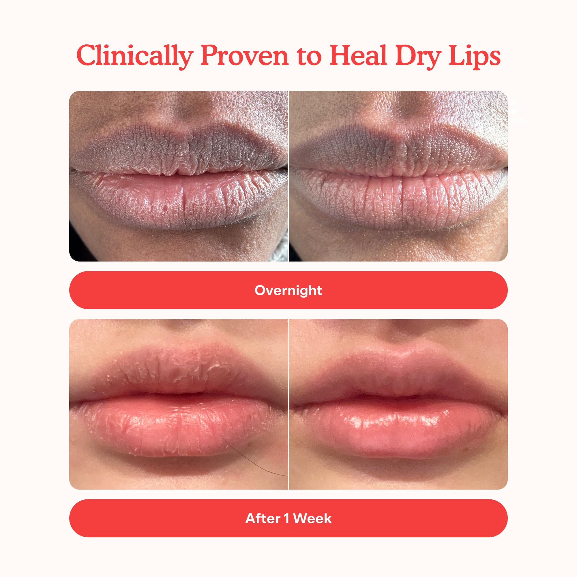Tower 28 LipSoftie Tinted Lip Balm Treatment - Hydrating Glossy Balm + Overnight Lip Mask with Jojoba Oil + Shea Butter - Sweet, Cushiony Formula for Smooth, Soft Lips - Watermelon Kiwi (0.38 oz) Tower 28Buy Supplements Australia