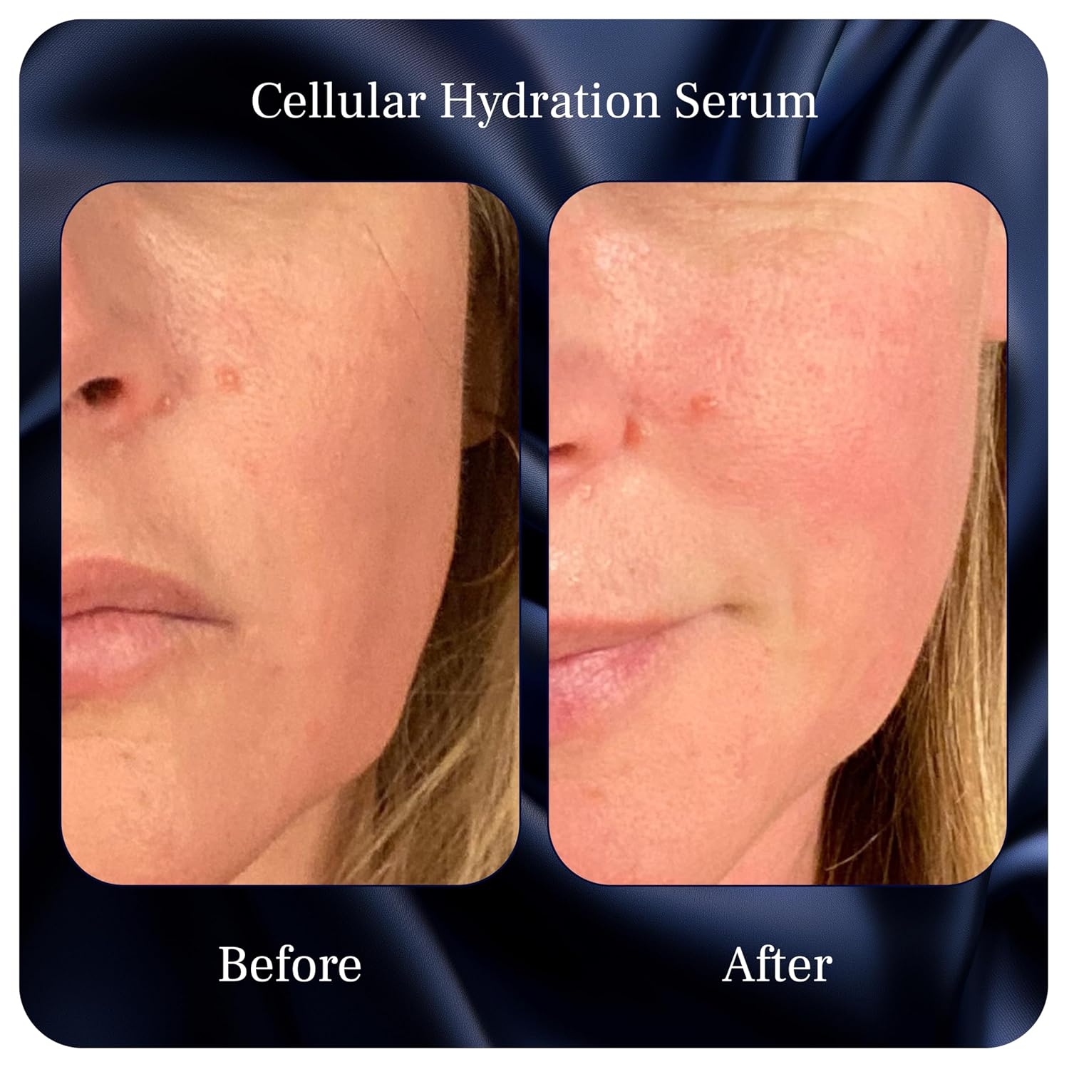Cellular Hydration Serum - Hyaluronic Acid Alternative Face Skin Serum | Hydrating Serum For Women & Men - Witch Hazel, Glycerin, Aloe, Calendula, Turkey Tail, Tremella Mushroom & More - 1 Fl Oz