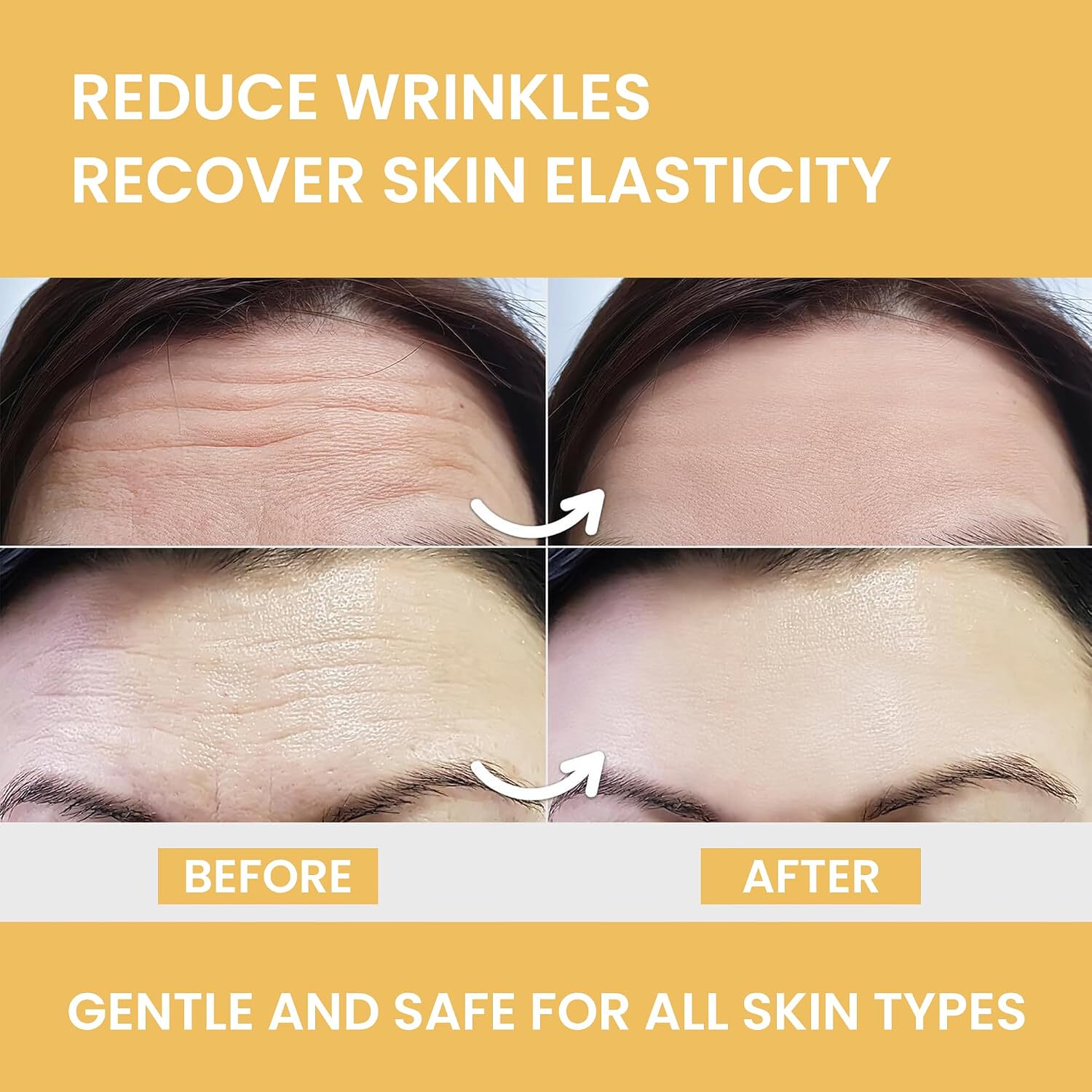 MONIER Forehead Wrinkle Patches Smoothing Overnight - Anti Wrinkle Patches | For Face And Forehead Fine Lines & Frown Lines, With Aloe, Collagen, Vitamin E, Hyaluronic Acid, 12 Pcs