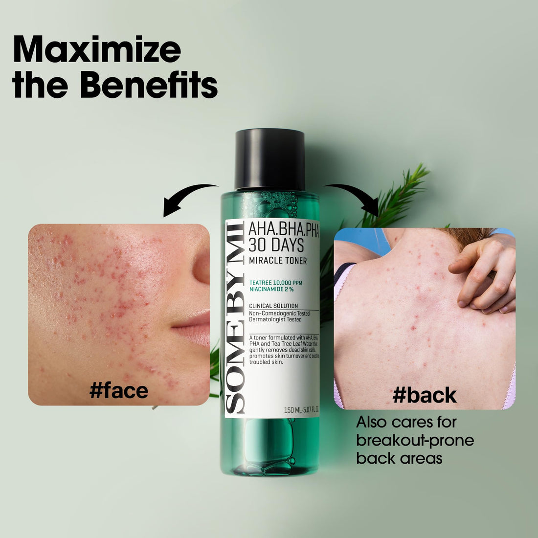SOME BY MI AHA BHA PHA 30 Days Miracle Toner – 5.07oz, 150ml – Korean Salicylic Acid Exfoliating Face Toner for All Skin Types - PrimeBioHealth - canada supplements