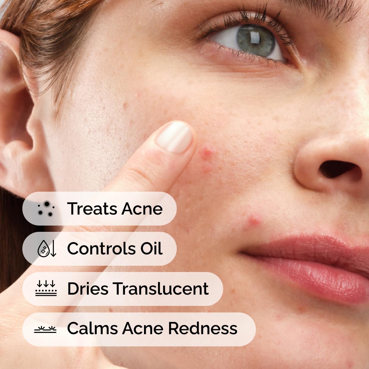 The Ordinary Sulfur 10% Powder-to-Cream Acne Spot Treatment Concentrate, Reduces Pimple Size and Zit Redness, 0.18 Oz - PrimeBioHealth - canada supplements